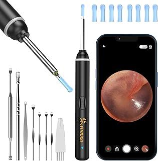VITCOCO Ear Wax Removal Kit, 1920P HD Ear Cleaner with Camera Ear Wax Remover Tool, WiFi Otoscope with 6 LED Lights & 8 Ear Spoons, Visual Ear Scope for iPhone iPad Android Adults Kids Pets(Black)
